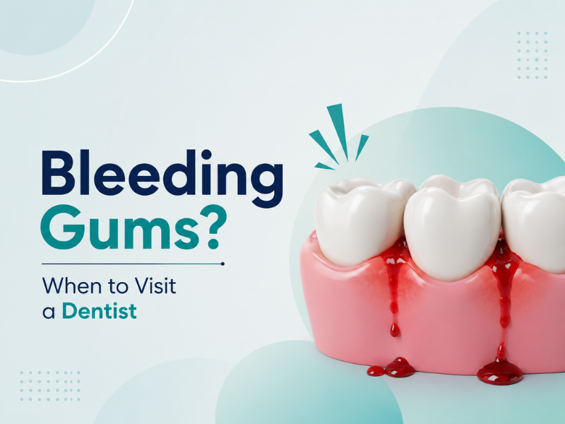 Bleeding Gums: When Should You Visit a Dentist? | Rainbow Dental, Rohini, Delhi